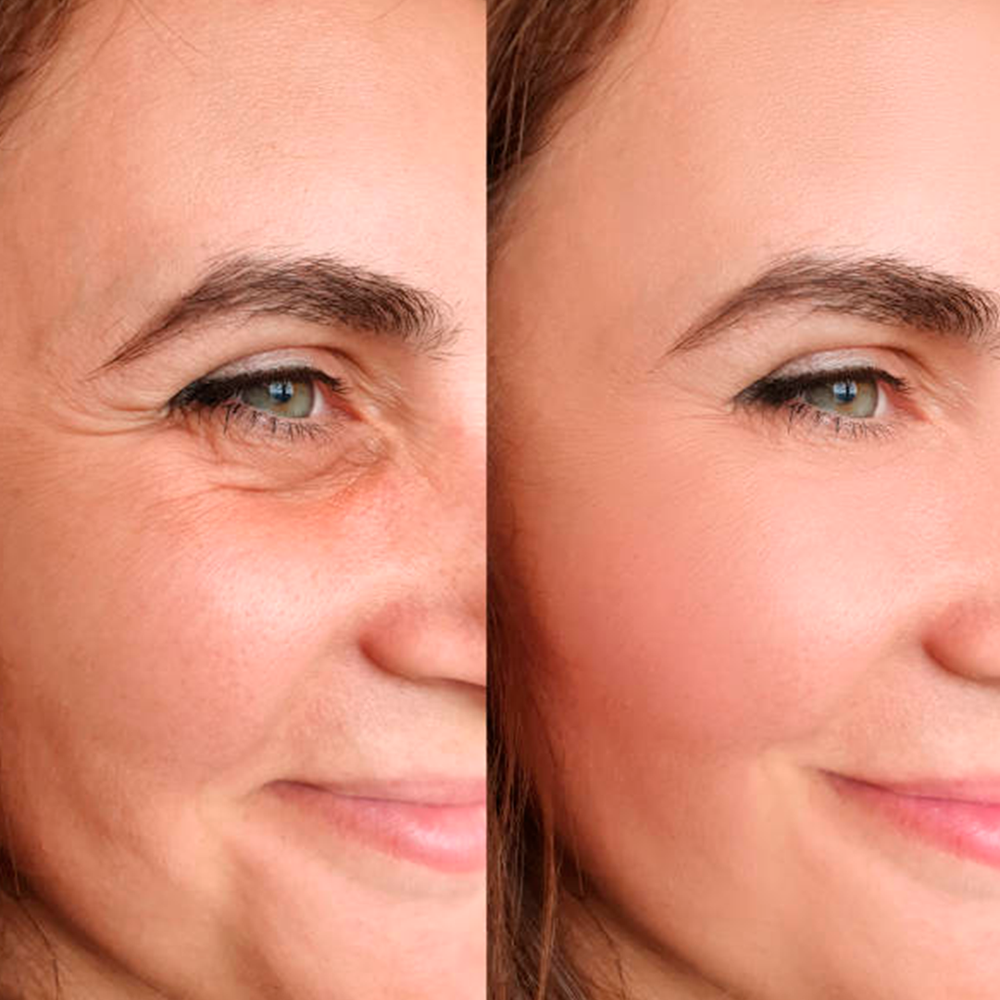 Advanced Snail Hydrogel Eye Patches