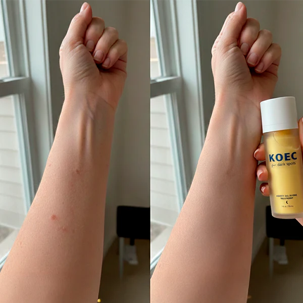 KOEC Advanced Dark Spot Serum